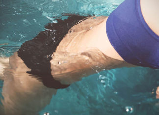 Usuwanie blizn i rozstępów nowoczesnymi metodami